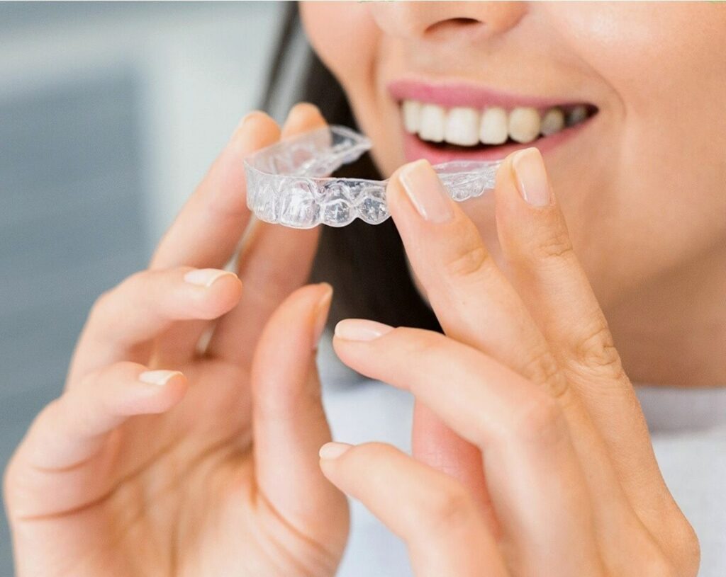 Tout savoir sur le traitement Invisalign - Cabinet dentaire Libération